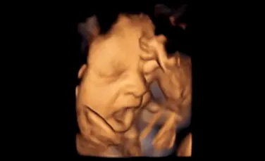 Imaginile 4D demonstrează că oamenii cască înainte să se nască (VIDEO)