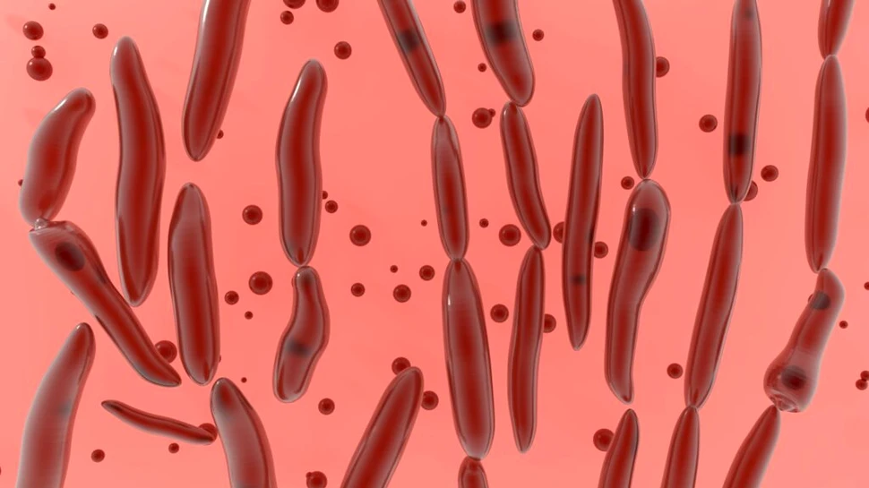 Focar de paralizie în Europa, legat de procedurile de „Botox stomacal”