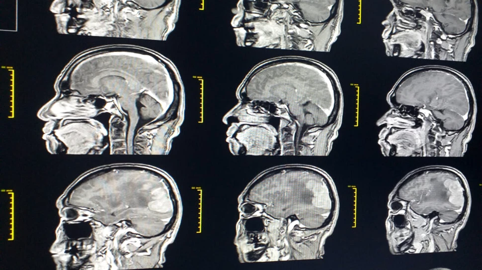 Memoria de scurtă durată poate fi îmbunătățită prin terapia cu laser
