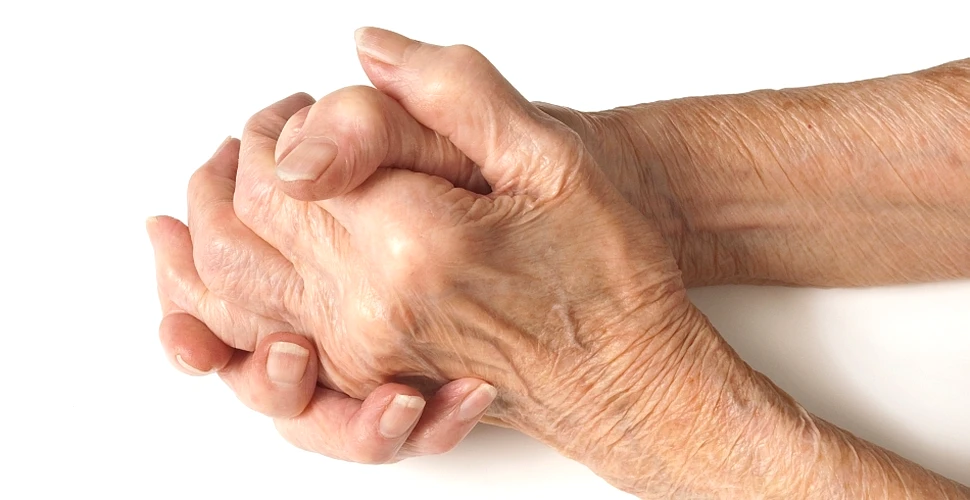 Lucrul esenţial pe care trebuie să îl facă fiecare om pentru a preveni artrita