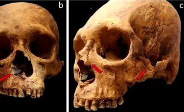 Ce au descoperit arheologii după ce au analizat scheletele unor oameni din 400 î.Hr.