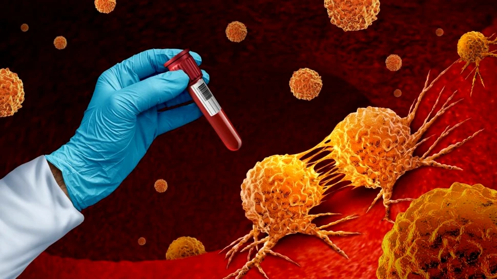 Cercetătorii au descoperit o nouă metodă de diagnosticare a cancerului intestinal