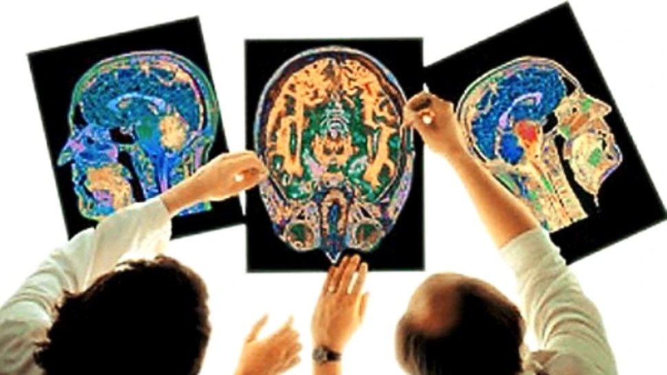 Scaneaza-ti creierul ca sa afli ce meserie ti se potriveste