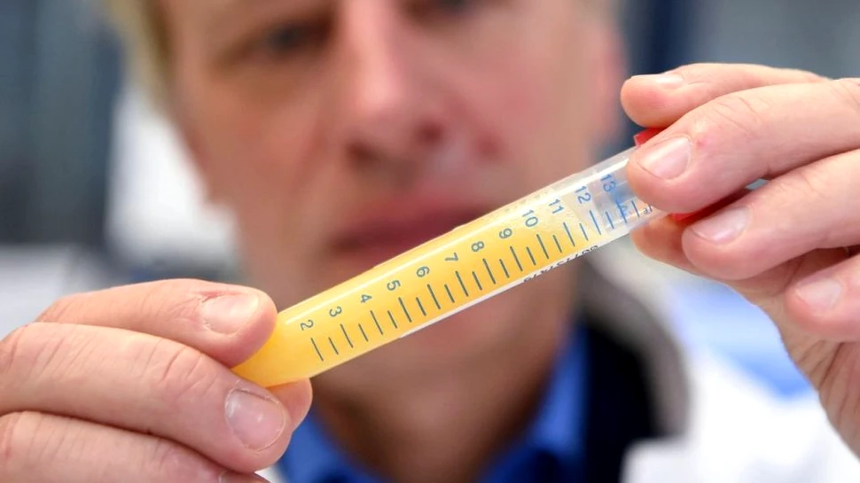 Lichidul seminal al bărbaţilor infectaţi poate conţine coronavirusul