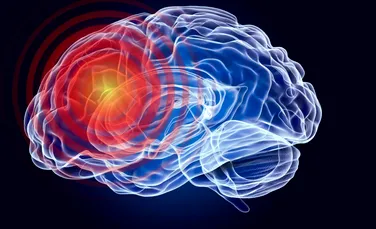 A fost descoperită o tulburare neurologică necunoscută până acum