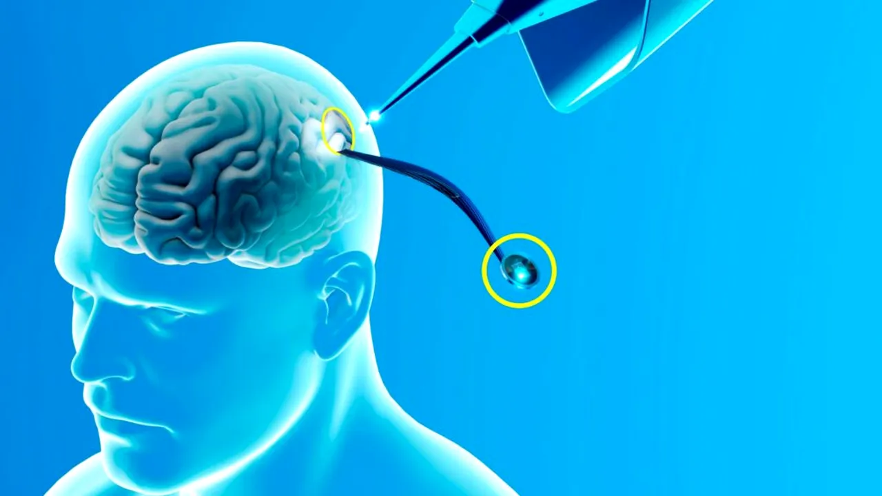 neuralink 