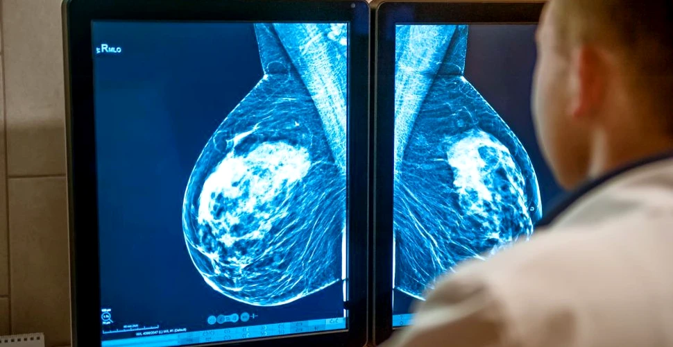 Poluanţii care favorizează dezvoltarea metastazelor cancerului de sân