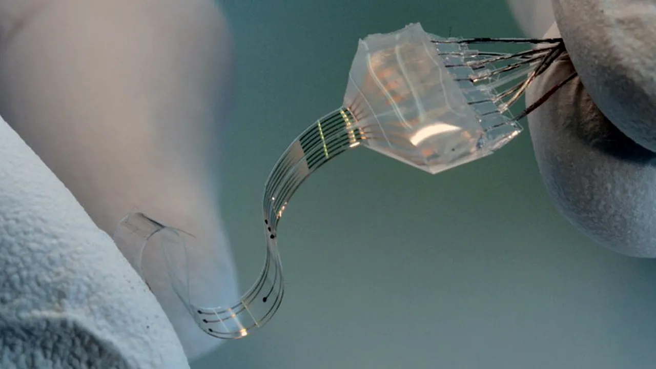 1-implantsparalyzed 