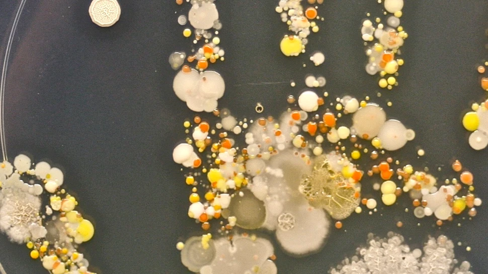 Cum arată bacteriile de pe mâna unui copil după ce iese afară la joacă – GALERIE FOTO