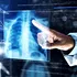 Radiografiile toracice ajută la diagnosticul timpuriu al cancerului pulmonar