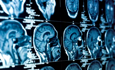 Inteligența artificială ar putea fi folosită pentru a diagnostica demența