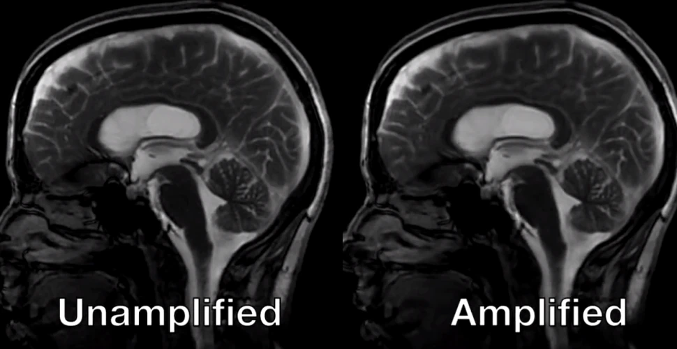 Ce se întâmplă cu creierul tău atunci când inima pompează sânge – VIDEO