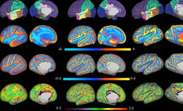 Cum evoluează creierul nou-născuţilor? Cercetătorii au scanat creierul bebeluşilor la câteva zile de la naştere