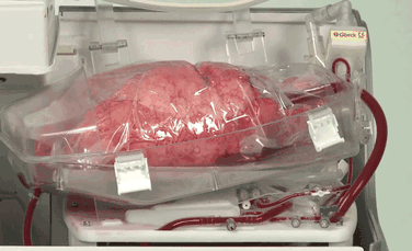 Cum respiră plămânii scoşi din piept? Uimitoarea tehnologie a „plămânului la cutie” menţine vii organele în afara corpului (VIDEO)
