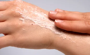 Cum să avem grijă de pielea noastră iarna, atunci când pierde mai multă apă?