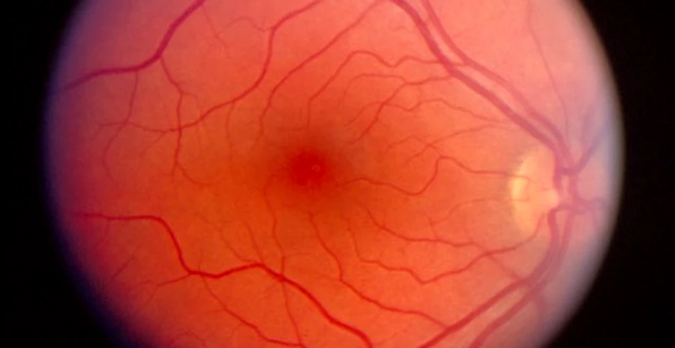 O retina artificiala din celule stem embrionale