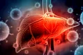 Diagnosticarea rapidă a virusului hepatitei C, posibilă cu un test inovator lansat recent
