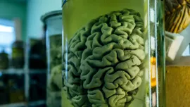 Universitatea daneză care găzduiește cea mai mare colecție de creieri umani din lume