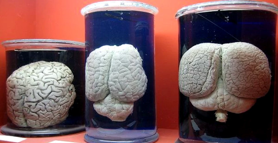 Putem cultiva un creier în laborator? Nu chiar, dar aproape…
