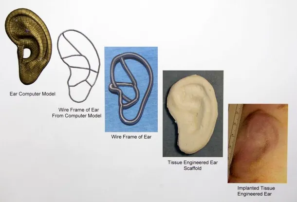 Piese de schimb pentru corpul uman: urechi „crescute” în laborator