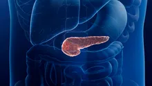 Cancerul pancreatic, depistat înainte să fie vizibil la tomografie. Ce aduce nou inteligența artificială