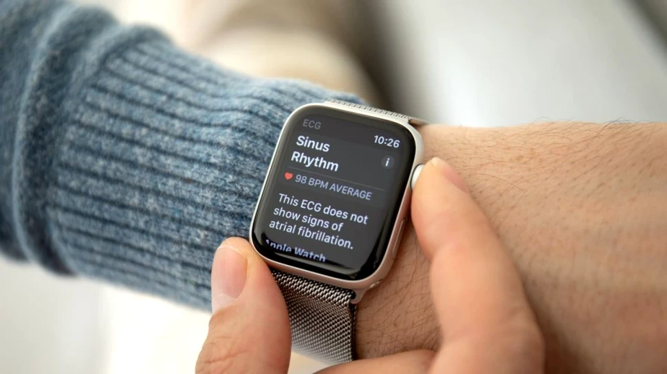 Oameni de știință din SUA: Ceasurile Apple care monitorizează funcția cardiacă declanșează alarme false