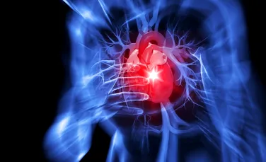 De ce poţi face atac de inimă chiar dacă nu ai colesterolul mărit?