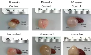 Mini-intestine umane, parțial funcționale, au fost crescute în șoareci