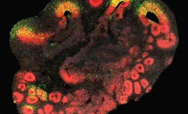Cercetătorii au descoperit gena căreia îi datorăm creierul nostru mare