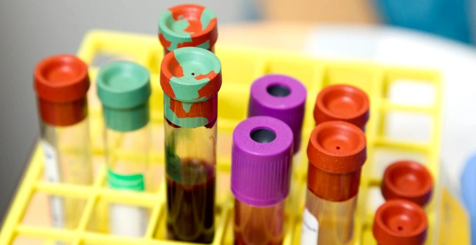 Un nou test poate găsi bacteriile rezistente la antibiotice din sângele unui pacient în doar o oră