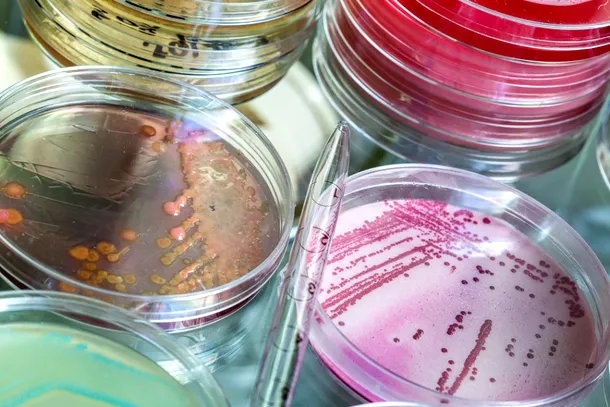 Mai puţin de 1% din totalul estimat al speciilor de microorganisme pot fi cultivate în laborator. 