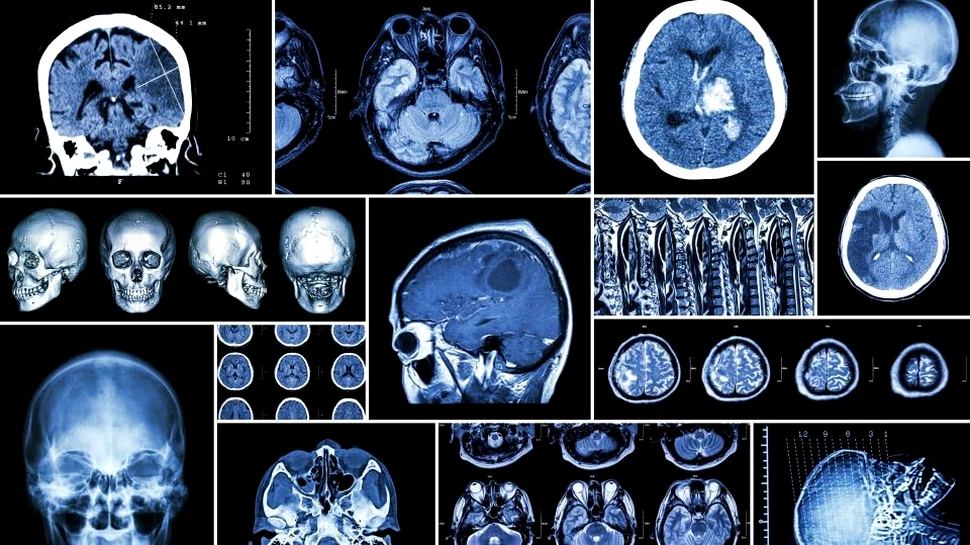 O nouă hartă detaliată a sistemului nervos a fost creată: poate oferi noi indicii cu privire la originea unor boli neurologice