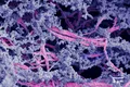 Un nou biomaterial regenerează cartilajul deteriorat din articulații