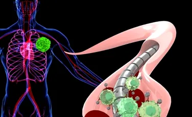 Nanoroboţii, folosiţi în proceduri revoluţionare pentru distrugerea tumorilor canceroase