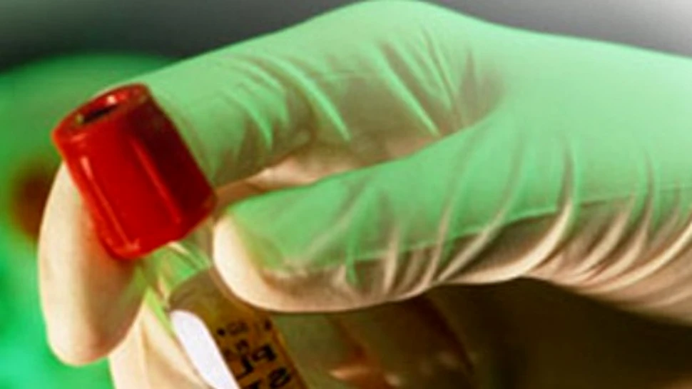 Circumcizia reduce riscul de infectare cu HIV