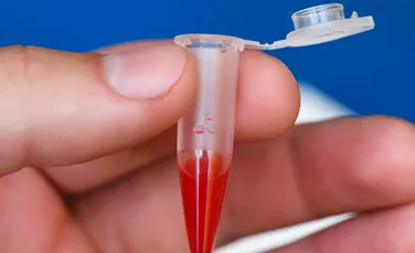 Viitoarele tratamente pentru slăbit ar putea fi create din sângele de piton