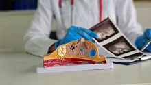 Mamografiile de rutină pot oferi indicii importante despre riscul cardiac