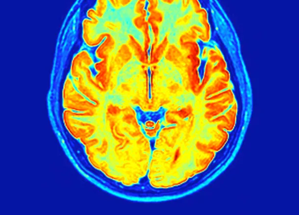 Oamenii de știință au modificat structura moleculară a LSD-ului și au creat un nou medicament pentru creier