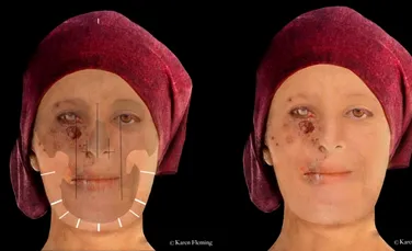 Cercetătorii au reconstruit chipul unei femei din secolul XVI-lea care a suferit de lepră