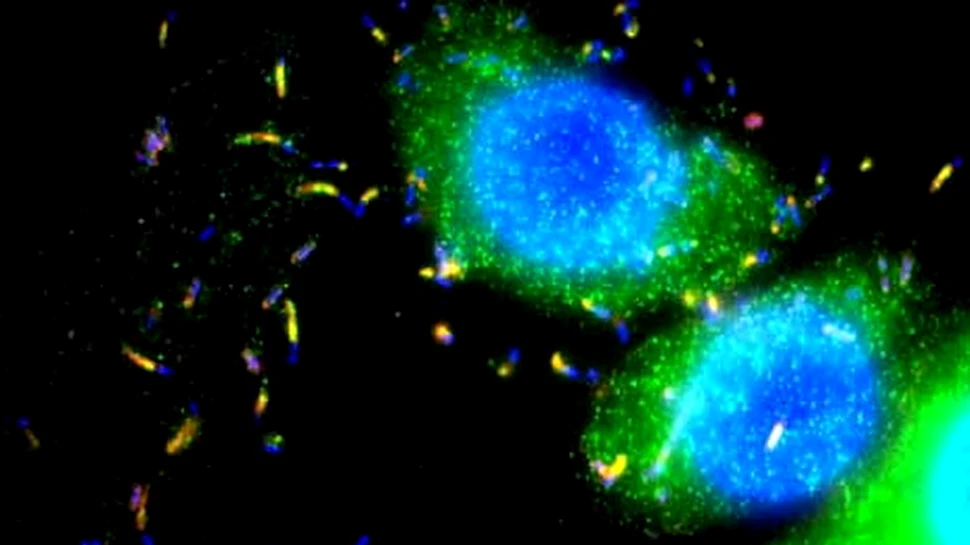 Bacterii impotriva cancerului