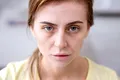 „Ferritin face”, noul termen viral de pe rețelele sociale. Ce legătură are cu deficitul de fier