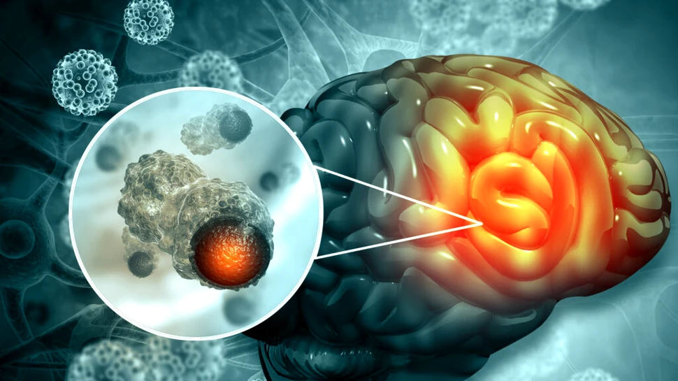 Un nou dispozitiv detectează tumorile cerebrale cu ajutorul urinei