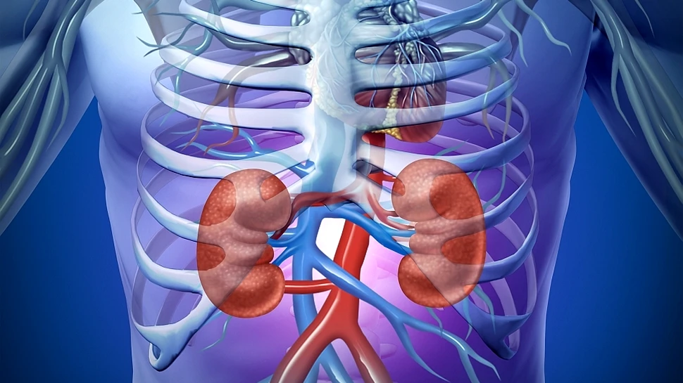 Când devine necesar transplantul renal