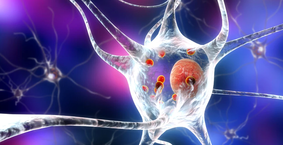 Boala Parkinson, mai ușor de diagnosticat cu inteligență artificială