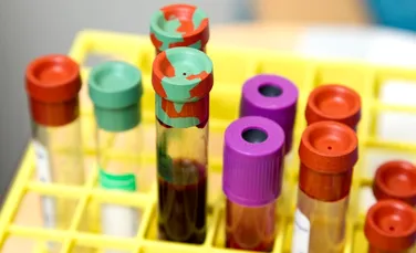 Un nou test poate găsi bacteriile rezistente la antibiotice din sângele unui pacient în doar o oră
