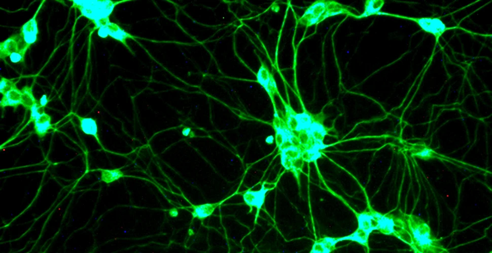 Celulele stem in lupta cu atacurile cerebrale