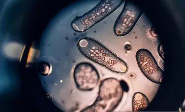 Inteligența Artificială poate detecta acum și infecțiile cu viermi paraziți