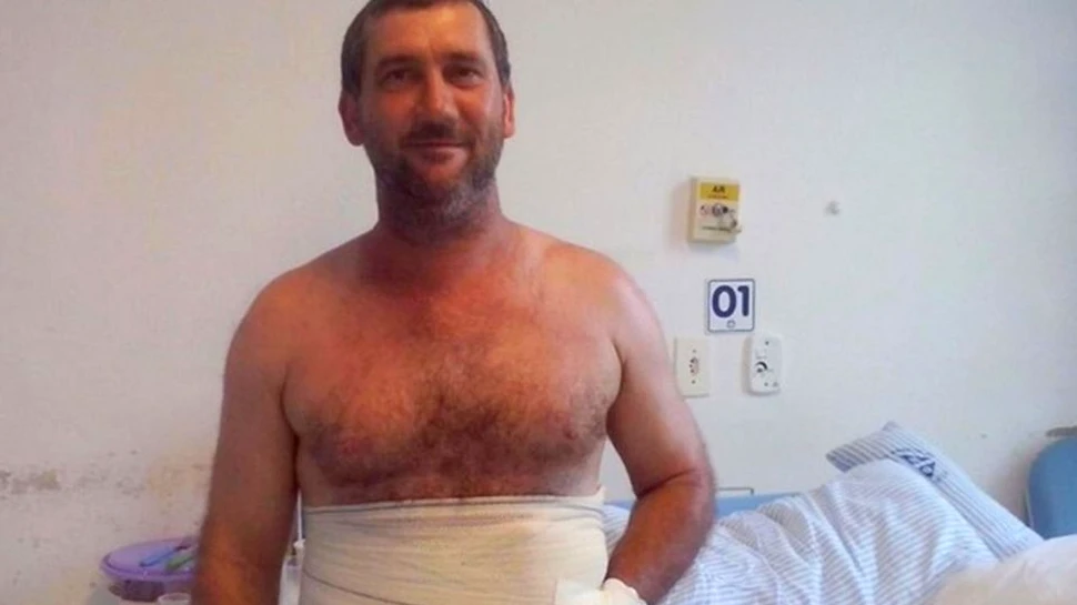Un chirurg brazilian a salvat mâna unui bărbat prin coaserea ei în ABDOMEN. ”Nu am putut să cred când mi-au spus” – FOTO+VIDEO