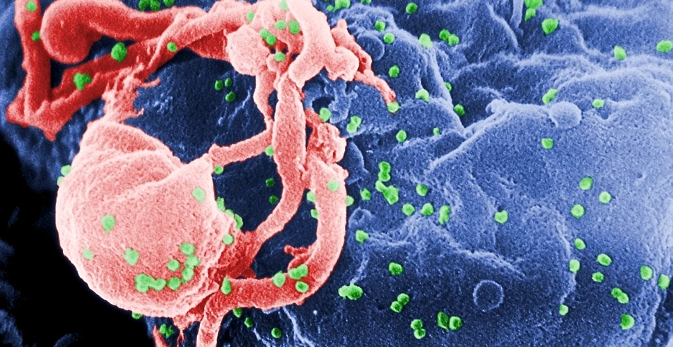 Reuşită extraordinară: un nou test permite detectarea „amprentei digitale” a anticorpilor HIV
