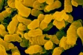 O bacterie mortală infectează copiii de peste 1.400 de ani